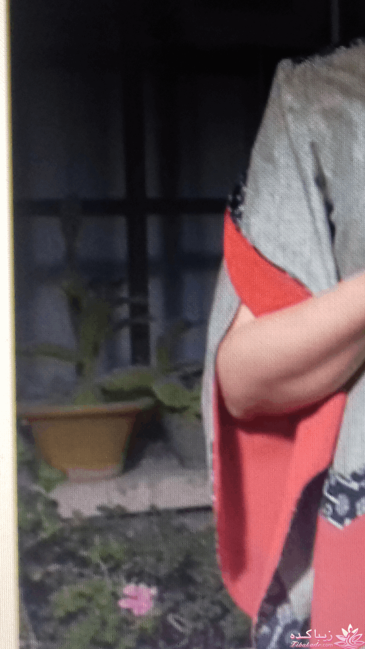 آموزش دوخت مانتو