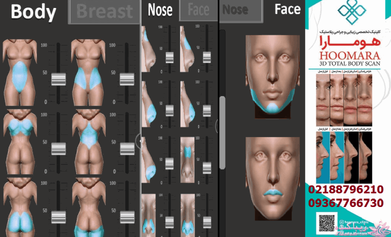 معرفی دکتر برای عمل بینی