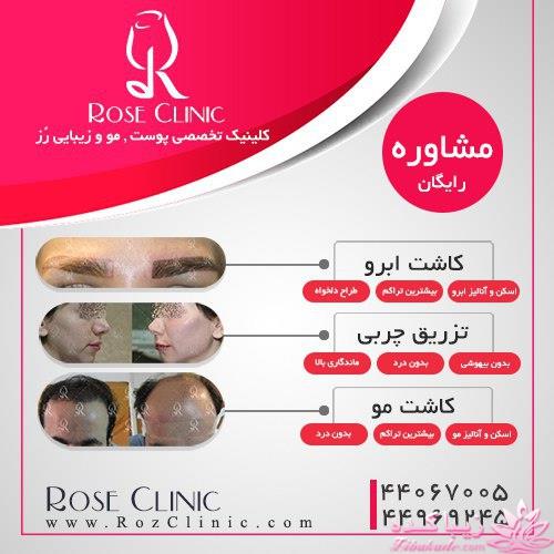 ترزیق ژل برای جوانتر شدن