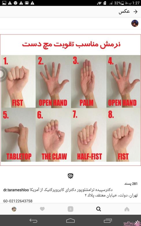 متخصصص ارتوپد مچ دست شمال تهران۰۲۱۲۲۶۴۳۷۵۸