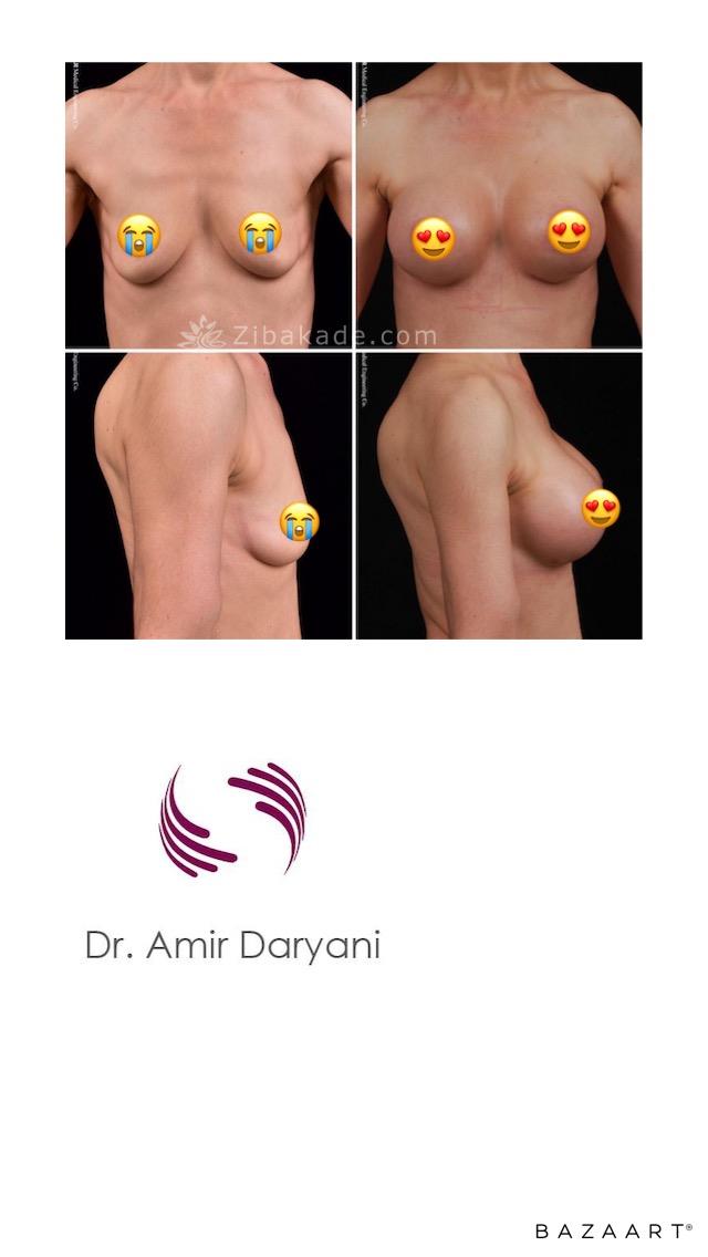 متخصص جراح ترمیمی پستان جراح پلاستیک خوب ۰۹۳۰۴۱۷۵۹۰۰