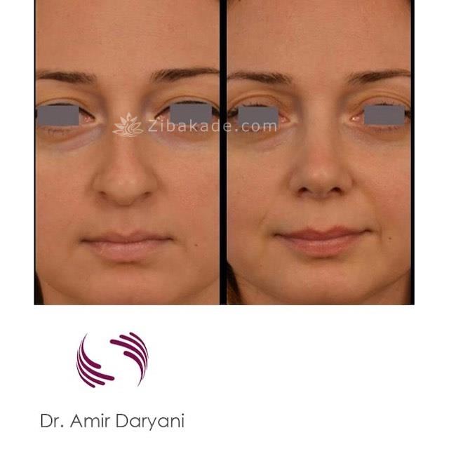 عملیات تجمیل الوجه وتحلل‌الشحوم و جراحة‌الصدر ایران00982188856920