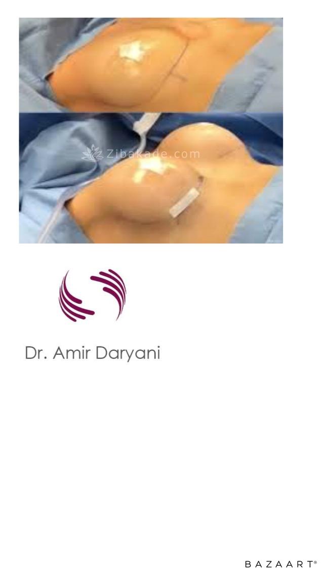 متخصص جراح ترمیمی پستان جراح پلاستیک خوب ۰۹۳۰۴۱۷۵۹۰۰