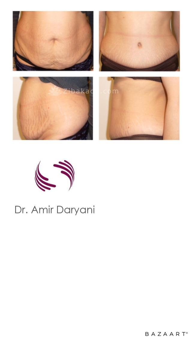 متخصص جراح ترمیمی پستان جراح پلاستیک خوب ۰۹۳۰۴۱۷۵۹۰۰