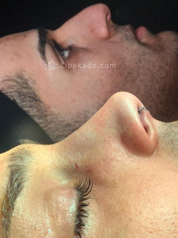 متخصص جراح ترمیمی پستان جراح پلاستیک خوب ۰۹۳۰۴۱۷۵۹۰۰