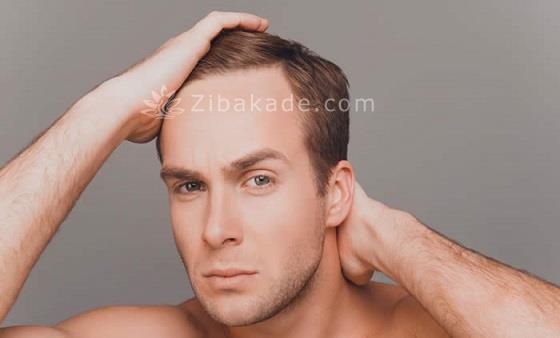 انتخاب بهترین کلینیک کاشت مو