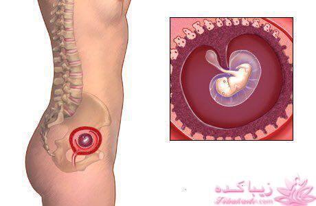 دوران بارداری با گلرو