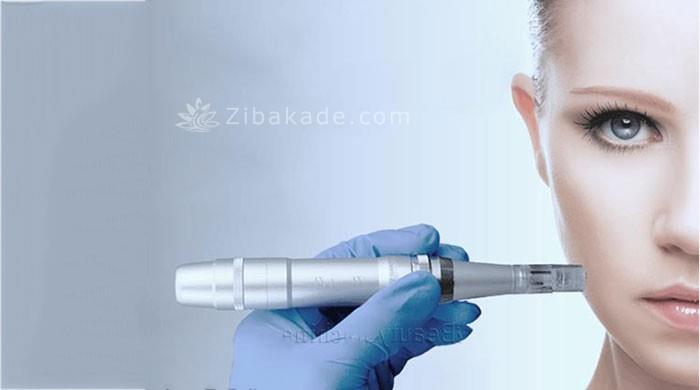 میکرونیدلینگ