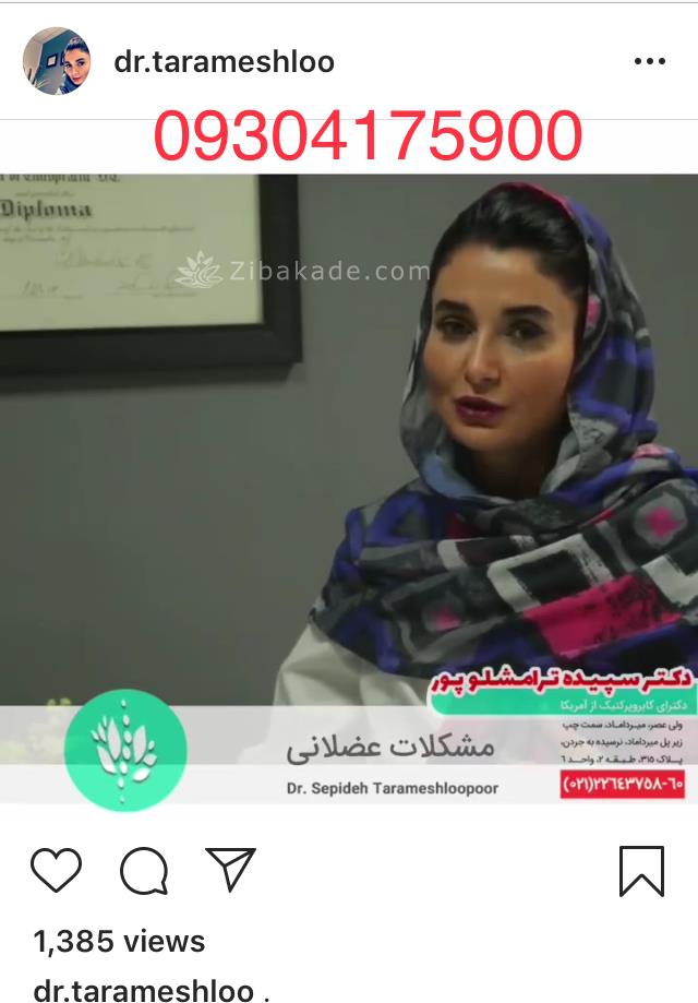 متخصص درمان انحراف ستون فقرات تهران