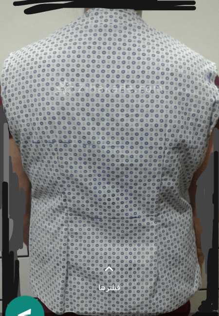 پرسش و پاسخ خیاطی به روش مولر