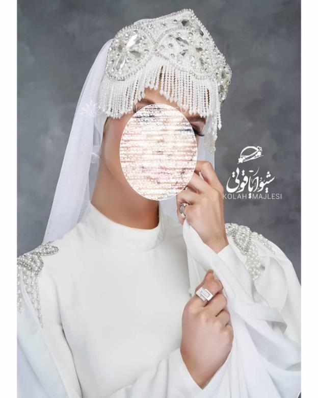 مانتو عقد از کجا بخرم