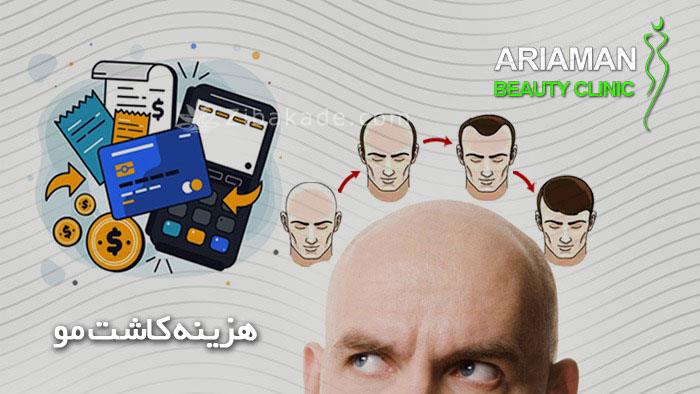 هزینه کاشت مو در ایران چقدر است ؟؟