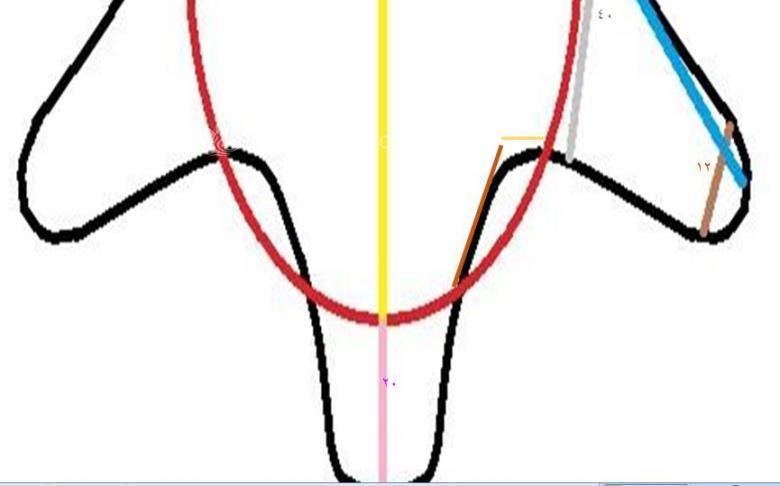 آموزش دوخت سیسمونی نوزاد