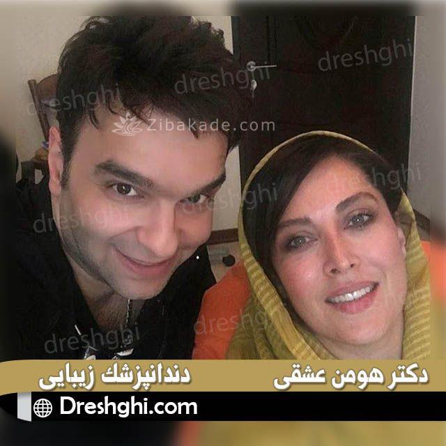 علت زرد شدن کامپوزیت دندان