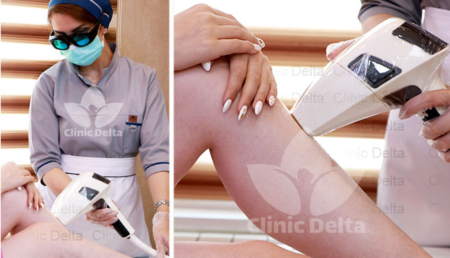 لیزر غرب تهران