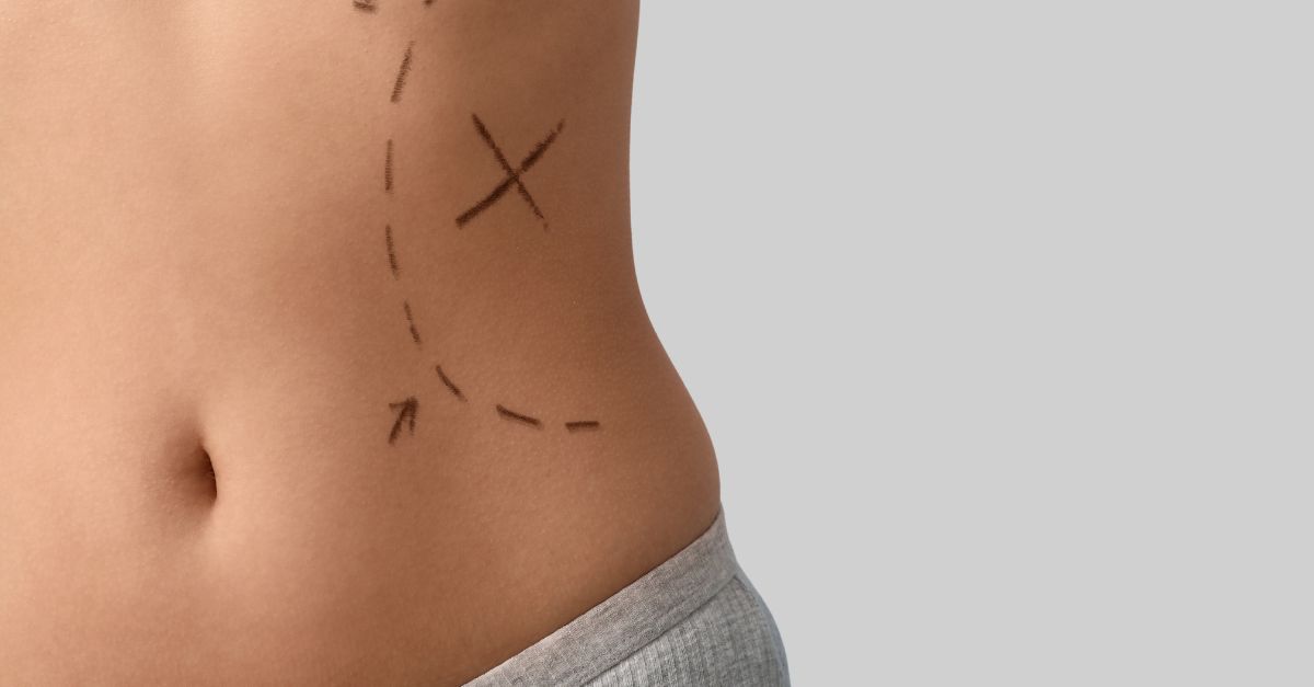 لاغری شکم و پهلو