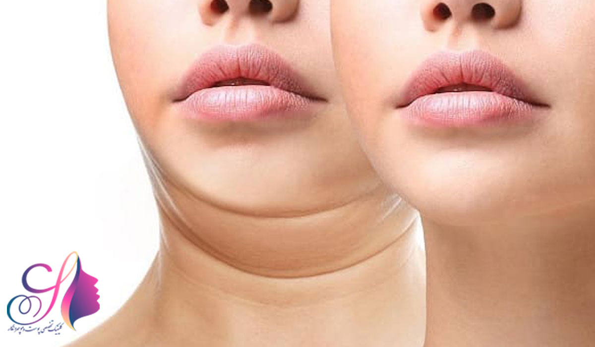 مزایای انتخاب چهره نگار