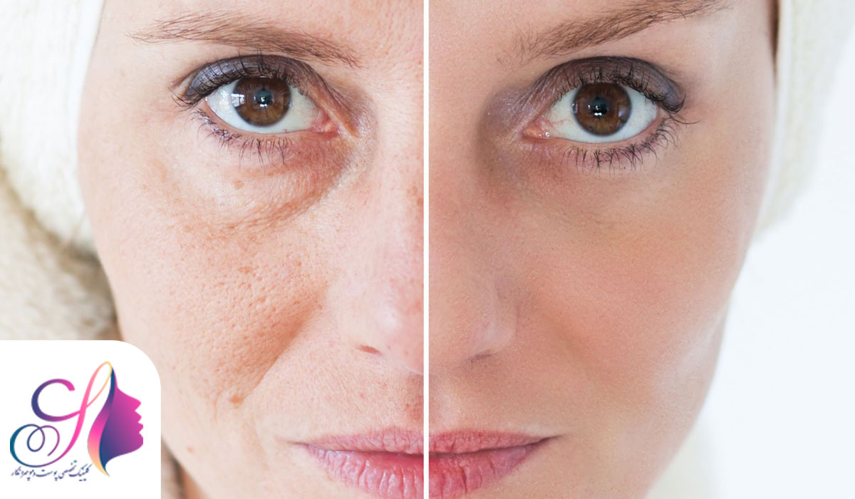 چهره نگار؛ تجربه ‌ای متفاوت از زیبایی با متدهای روز دنیا