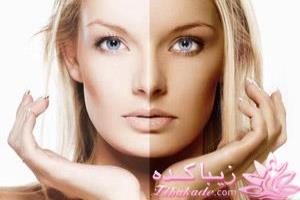 سریع ترین روش برای برطرف کردن رنگ برنزه پوست 