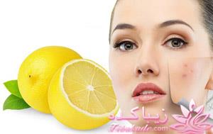 درمان های طبیعی برای رفع جوش های صورت